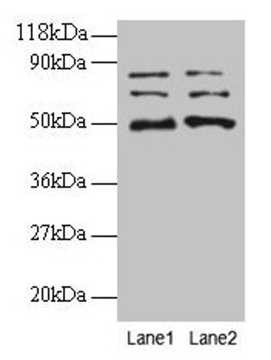 Western blot. All lanes: VOPP1 antibody at 2µg/ml. Lane 1: EC109 whole cell lysate. Lane 2: 293T whole cell lysate. Secondary. Goat polyclonal to rabbit IgG at 1/15000 dilution. Predicted band size: 20, 19, 18 kDa. Observed band size: 50, 70, 80 kDa