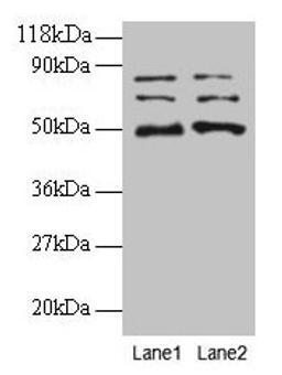 Western blot. All lanes: VOPP1 antibody at 2µg/ml. Lane 1: EC109 whole cell lysate. Lane 2: 293T whole cell lysate. Secondary. Goat polyclonal to rabbit IgG at 1/15000 dilution. Predicted band size: 20, 19, 18 kDa. Observed band size: 50, 70, 80 kDa