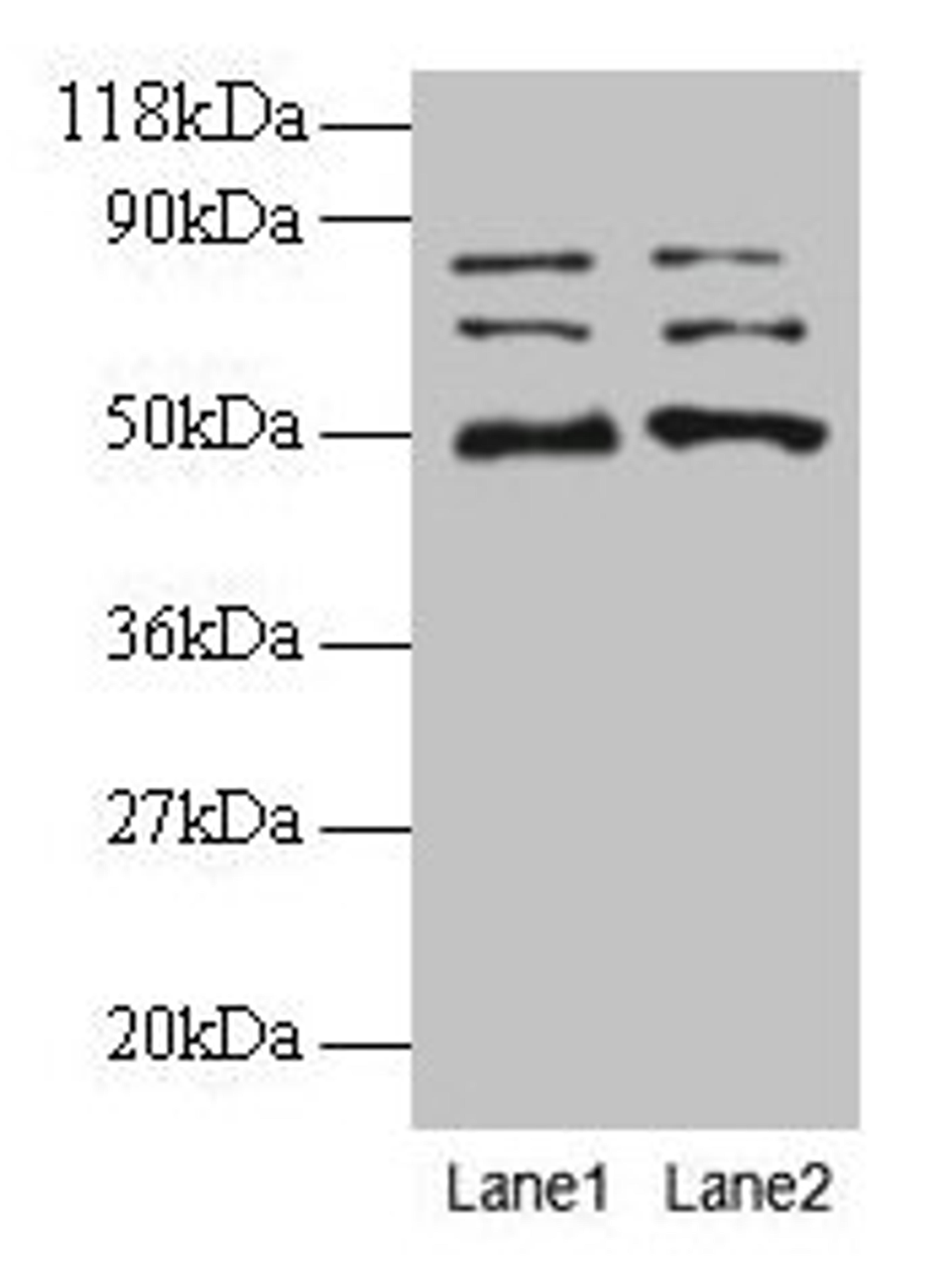 Western blot. All lanes: VOPP1 antibody at 2µg/ml. Lane 1: EC109 whole cell lysate. Lane 2: 293T whole cell lysate. Secondary. Goat polyclonal to rabbit IgG at 1/15000 dilution. Predicted band size: 20, 19, 18 kDa. Observed band size: 50, 70, 80 kDa