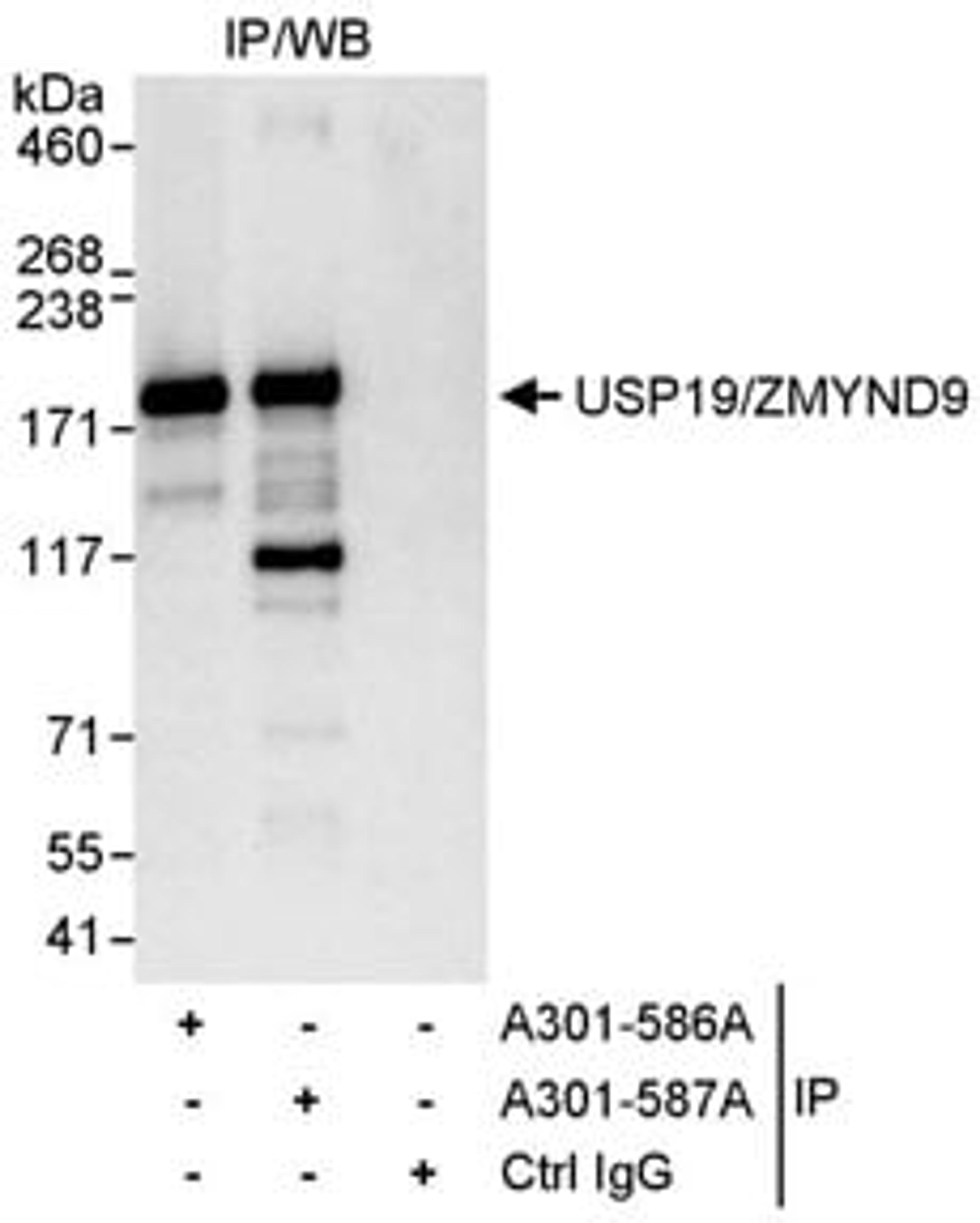 Detection of human USP19/ZMYND9 by western blot of immunoprecipitates.