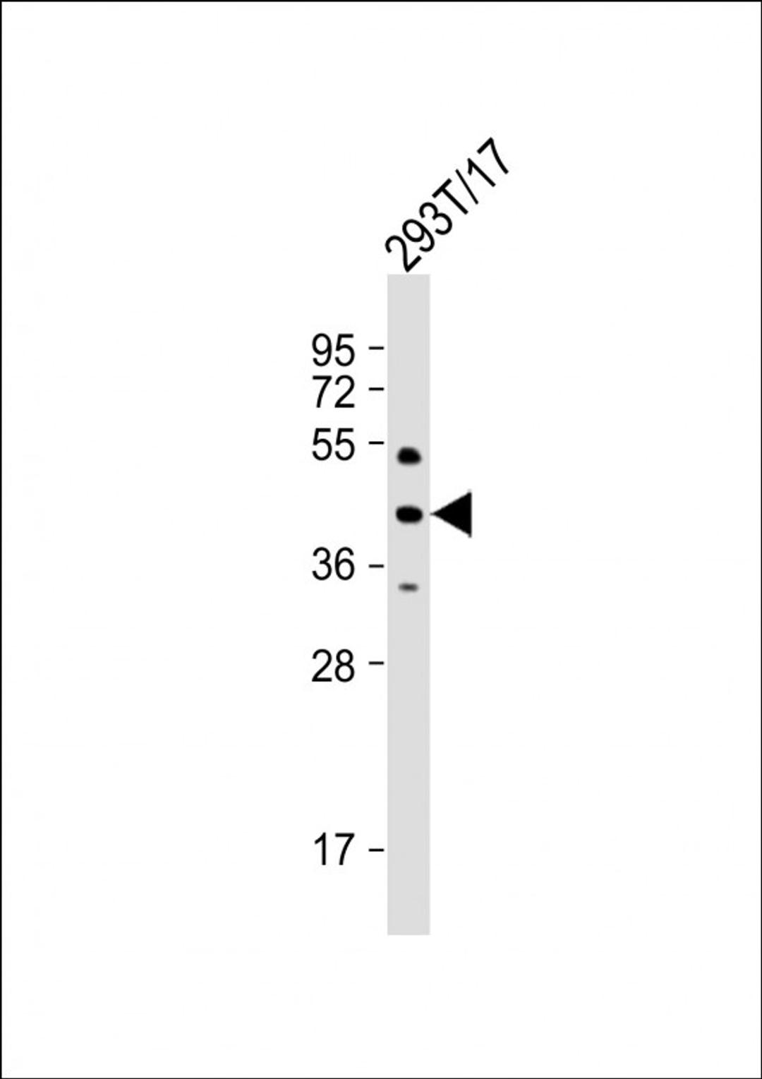 Western Blot at 1:1000 dilution + 293T/17 whole cell lysate Lysates/proteins at 20 ug per lane.