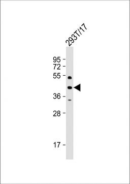 Western Blot at 1:1000 dilution + 293T/17 whole cell lysate Lysates/proteins at 20 ug per lane.