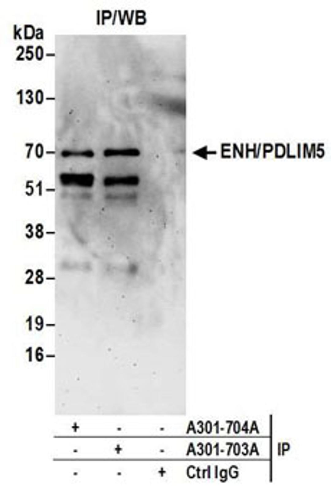 Detection of human ENH/PDLIM5 by western blot of immunoprecipitates.