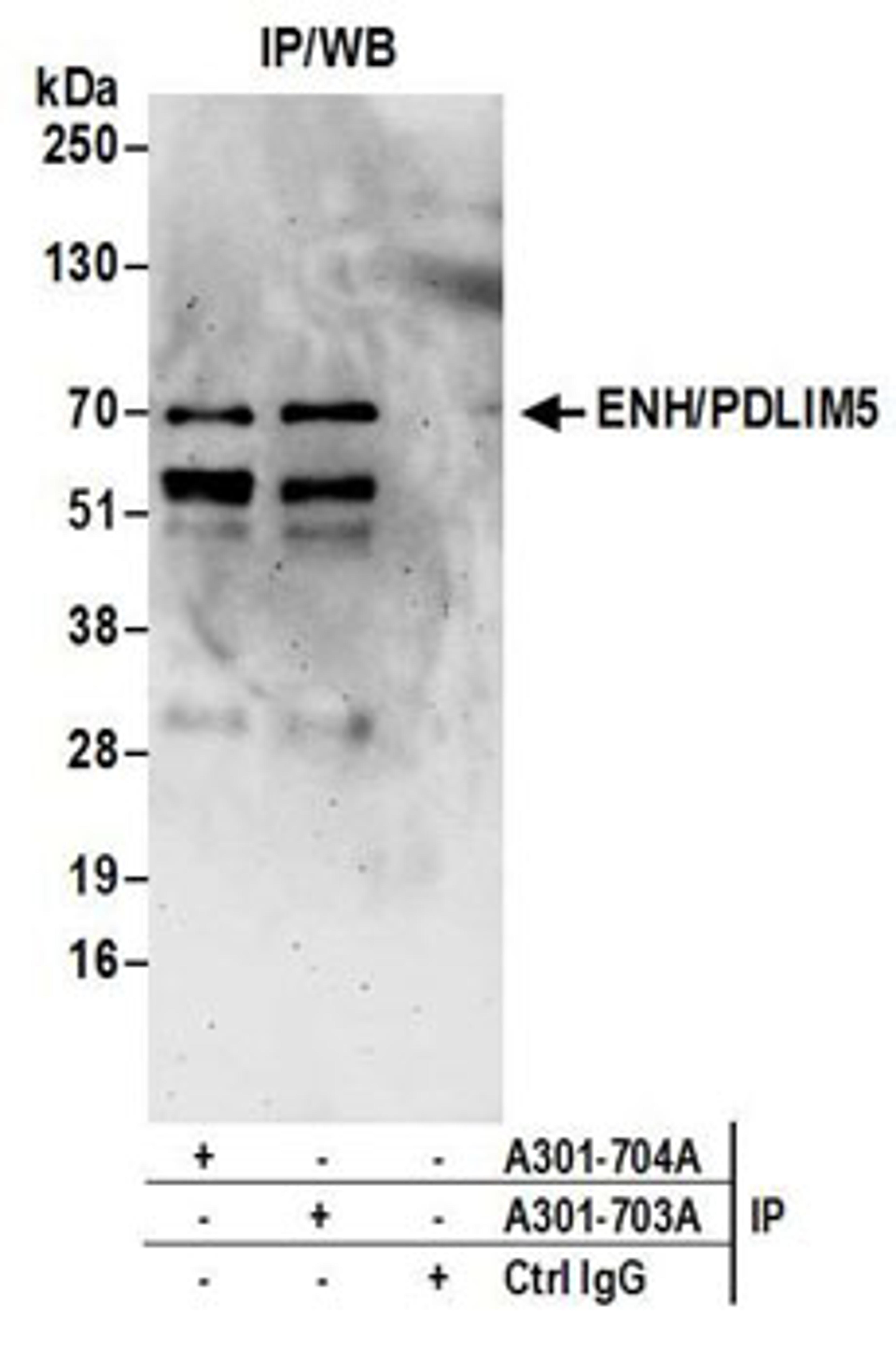 Detection of human ENH/PDLIM5 by western blot of immunoprecipitates.