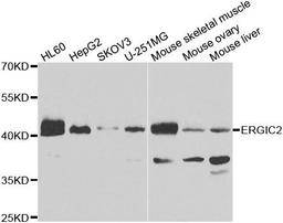 Western blot analysis of extracts of various cell lines using ERGIC2 antibody