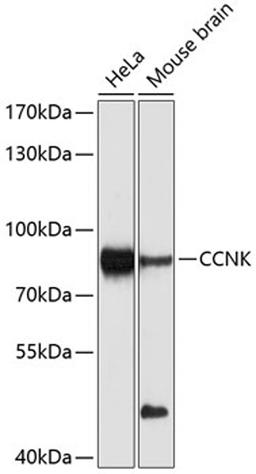 Western blot - CCNK Antibody (A10261)