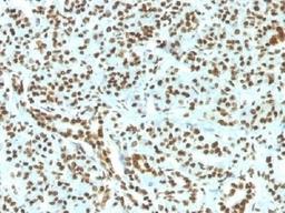 IHC testing of FFPE human pancreas and recombinant Histone H1 antibody (clone HH1/1784R). Required HIER: boil tissue sections in 10mM citrate buffer, pH 6, for 10-20 min.