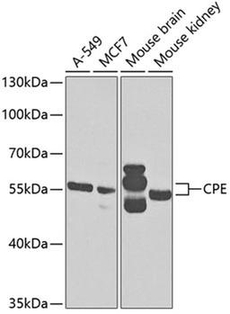 Western blot - CPE antibody (A5458)