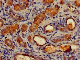 Immunohistochemistry of paraffin-embedded human kidney tissue using CSB-PA887153LA01HU at dilution of 1:100