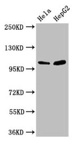 Western Blot. Positive WB detected in: Hela whole cell lysate, HepG2 whole cell lysate. All lanes: CTNNA1 antibody at 3.3µg/ml. Secondary. Goat polyclonal to rabbit IgG at 1/50000 dilution. Predicted band size: 101, 103, 60 kDa. Observed band size: 101 kDa