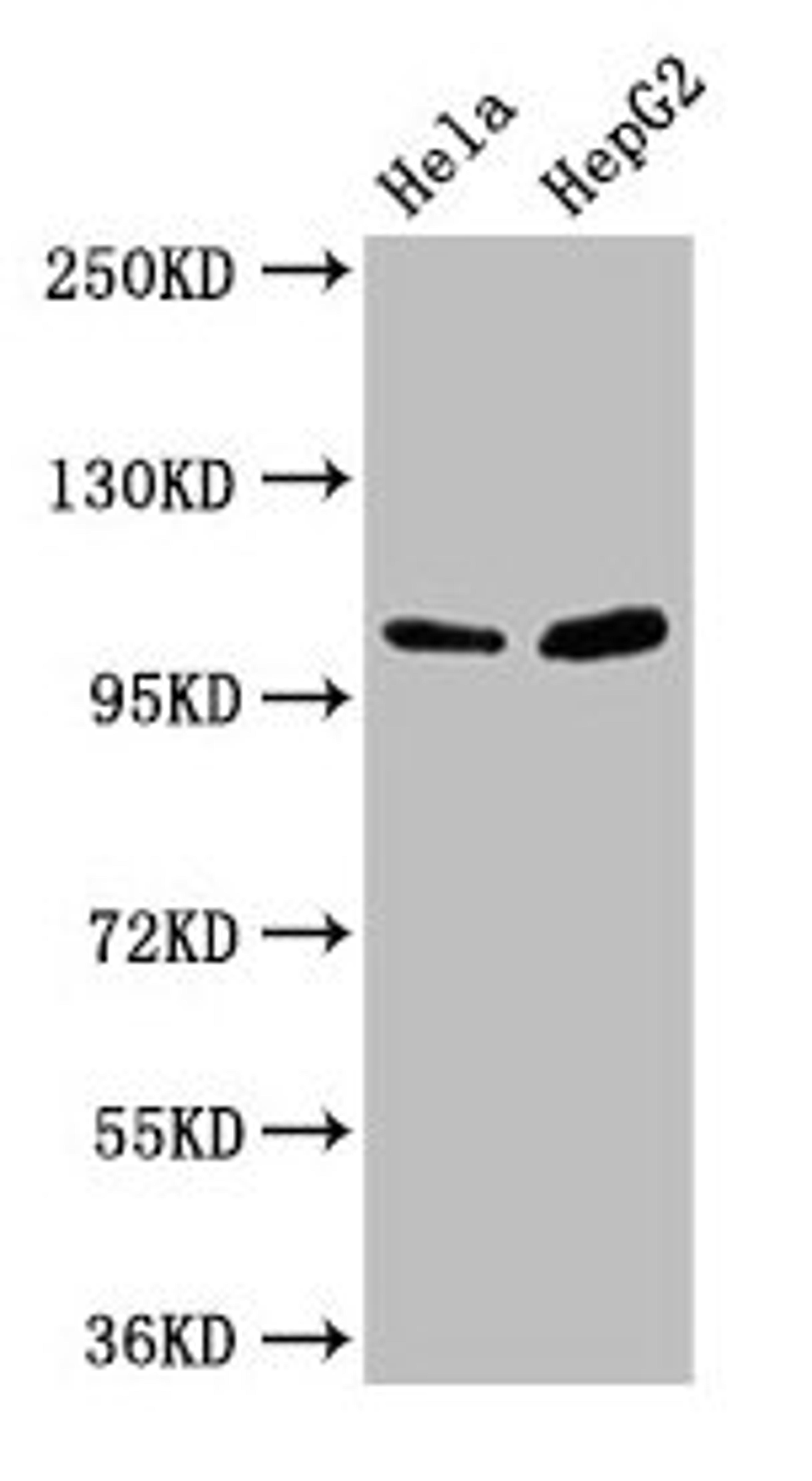 Western Blot. Positive WB detected in: Hela whole cell lysate, HepG2 whole cell lysate. All lanes: CTNNA1 antibody at 3.3µg/ml. Secondary. Goat polyclonal to rabbit IgG at 1/50000 dilution. Predicted band size: 101, 103, 60 kDa. Observed band size: 101 kDa