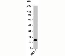 Western blot testing of human samples with Survivin antibody at 2ug/ml.