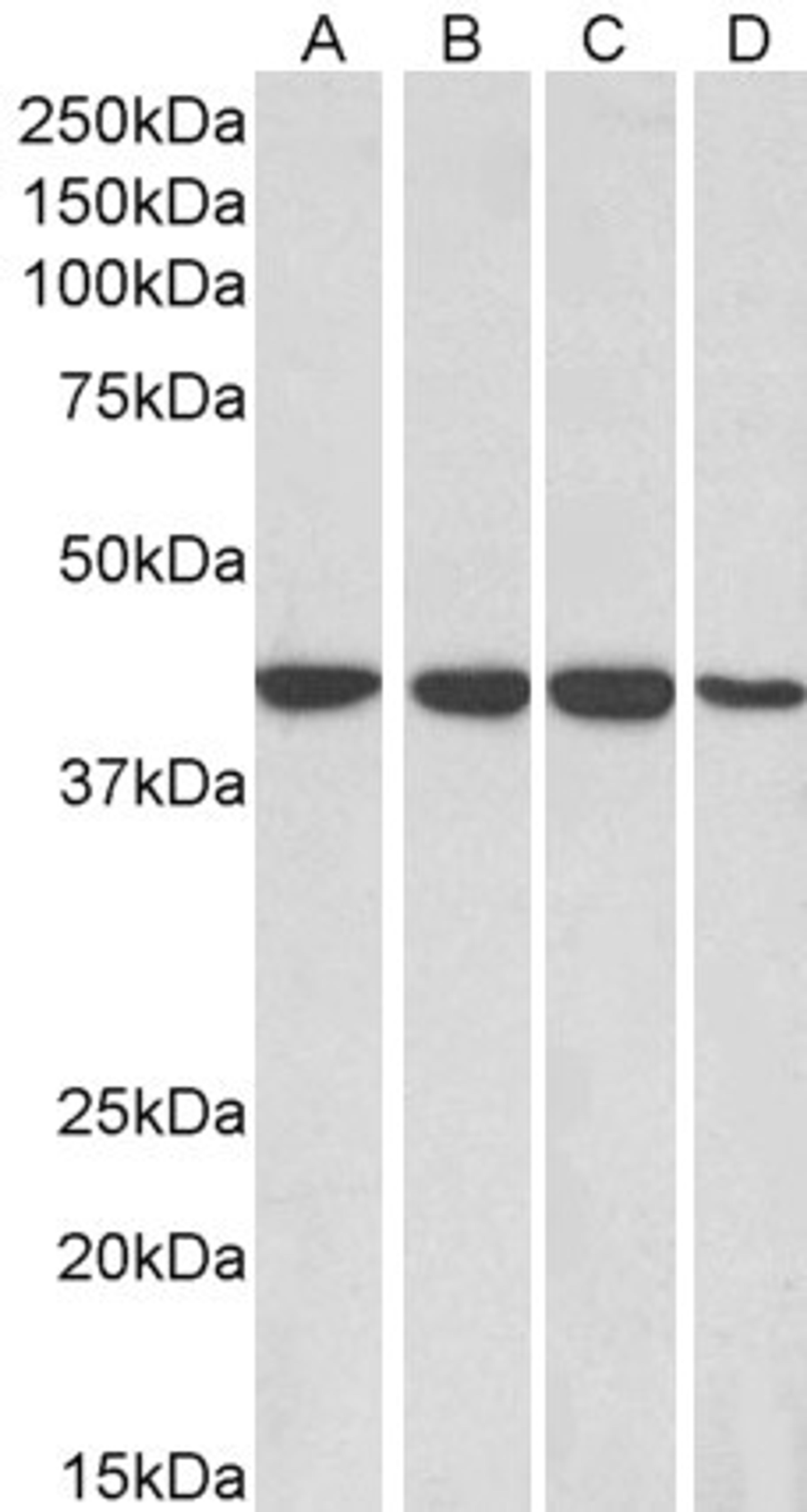 46-264 (0.1ug/ml) staining of HepG2 (A), HeLa (B), Jurkat (C) and MCF7 (D) lysates (35ug protein in RIPA buffer). Primary incubation was 1 hour. Detected by chemiluminescence.