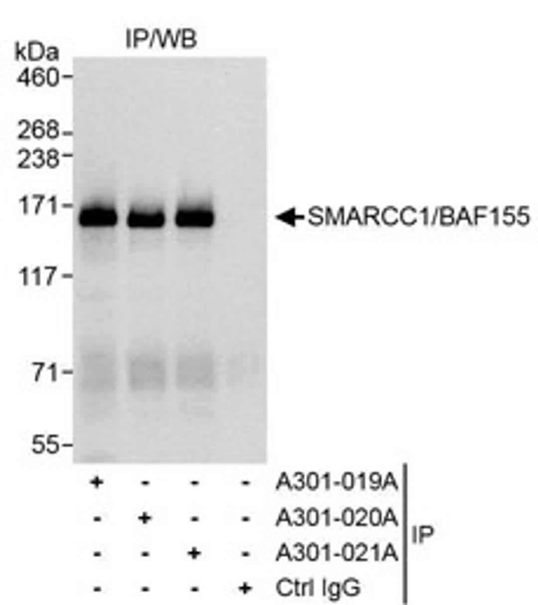 Detection of human SMARCC1/BAF155 by western blot of immunoprecipitates.