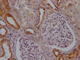 IHC image of CSB-RA799368A0HU diluted at 1:100 and staining in paraffin-embedded human kidney tissue performed on a Leica BondTM system. After dewaxing and hydration, antigen retrieval was mediated by high pressure in a citrate buffer (pH 6.0). Section was blocked with 10% normal goat serum 30min at RT. Then primary antibody (1% BSA) was incubated at 4℃ overnight. The primary is detected by a Goat anti-rabbit IgG polymer labeled by HRP and visualized using 0.05% DAB.