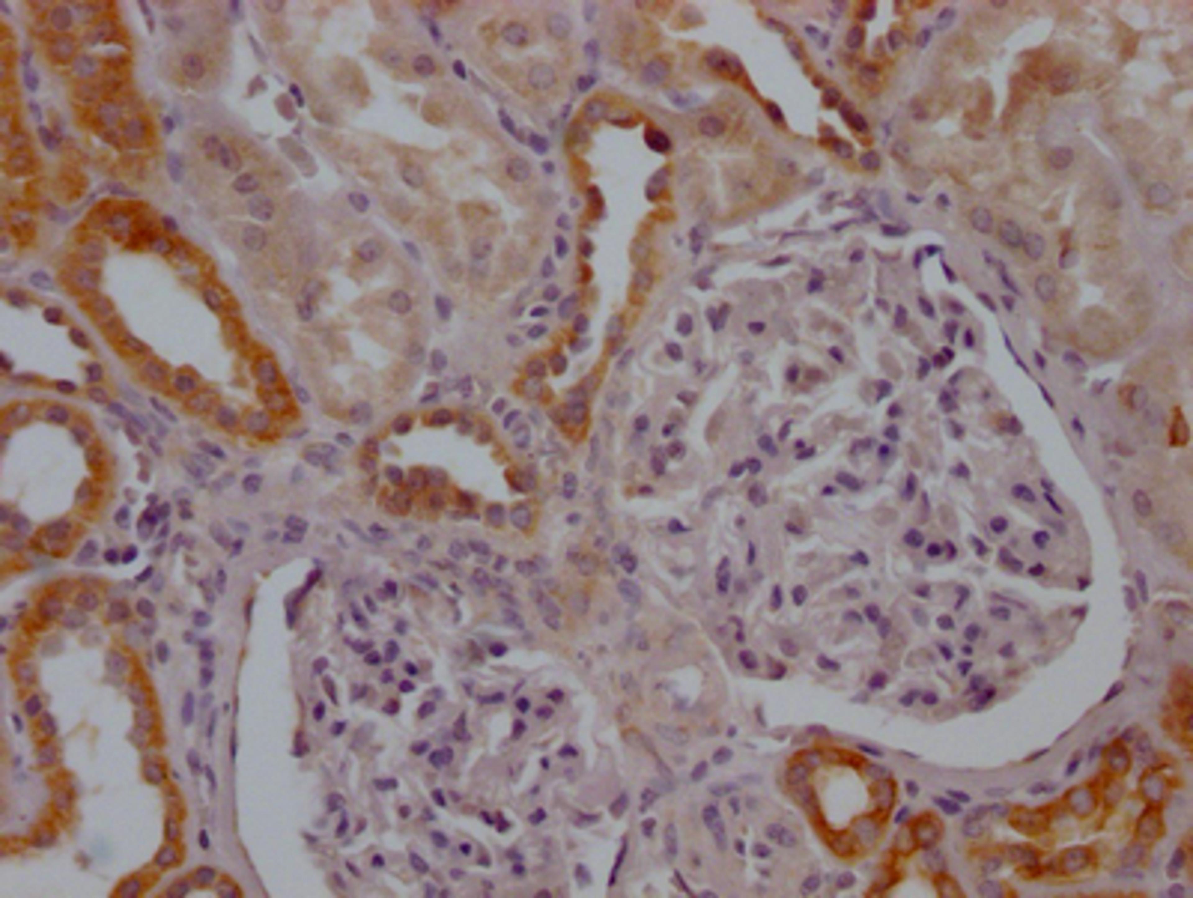 IHC image of CSB-RA799368A0HU diluted at 1:100 and staining in paraffin-embedded human kidney tissue performed on a Leica BondTM system. After dewaxing and hydration, antigen retrieval was mediated by high pressure in a citrate buffer (pH 6.0). Section was blocked with 10% normal goat serum 30min at RT. Then primary antibody (1% BSA) was incubated at 4℃ overnight. The primary is detected by a Goat anti-rabbit IgG polymer labeled by HRP and visualized using 0.05% DAB.