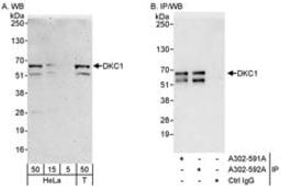 Detection of human DKC1 by western blot and immunoprecipitation.