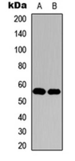 Western blot analysis of HeLa (Lane1), NIH3T3 (Lane2) whole cell using Histone Deacetylase 1 antibody