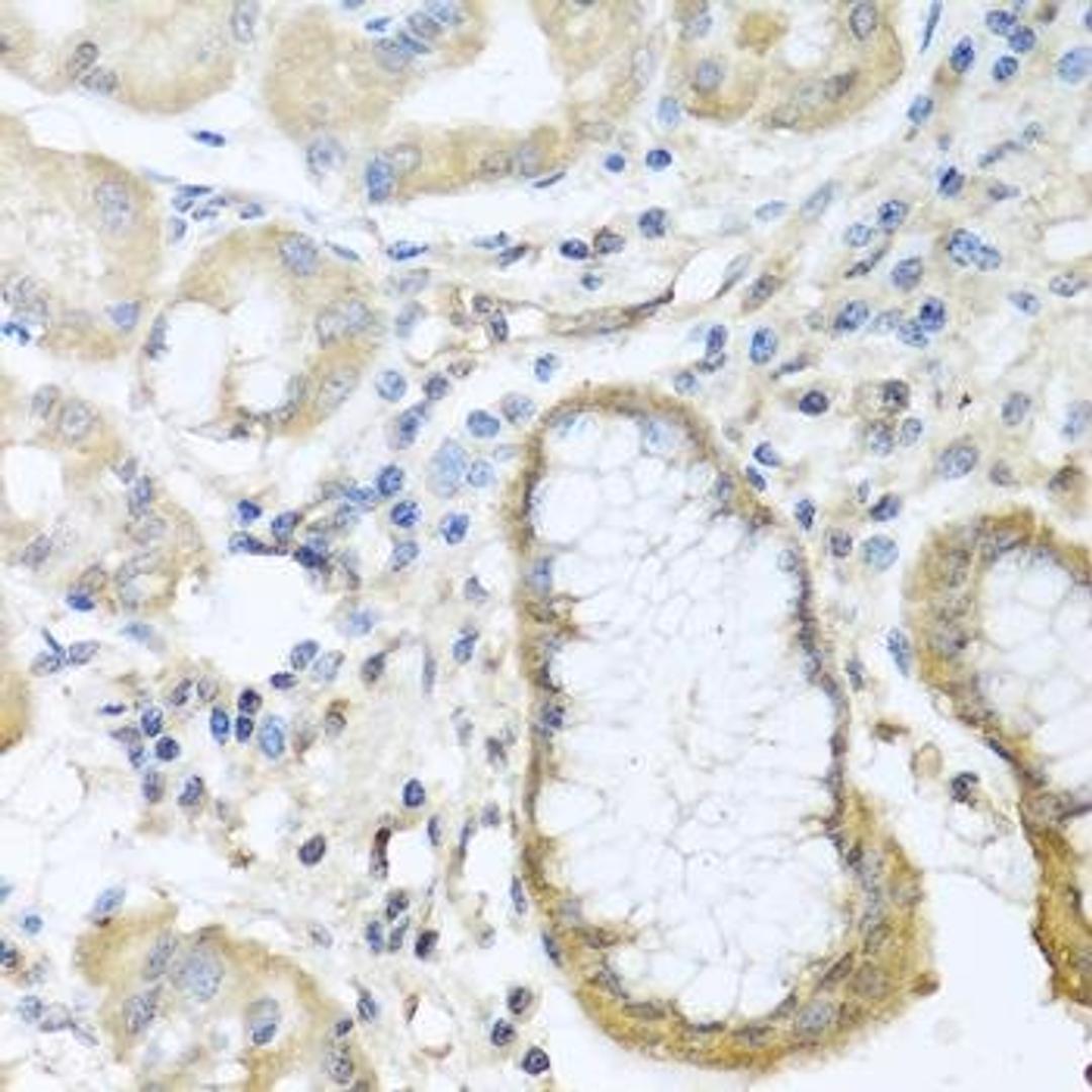 Immunohistochemical staining of rat lung tissue using CCL11 antibody (dilution of 1:100)