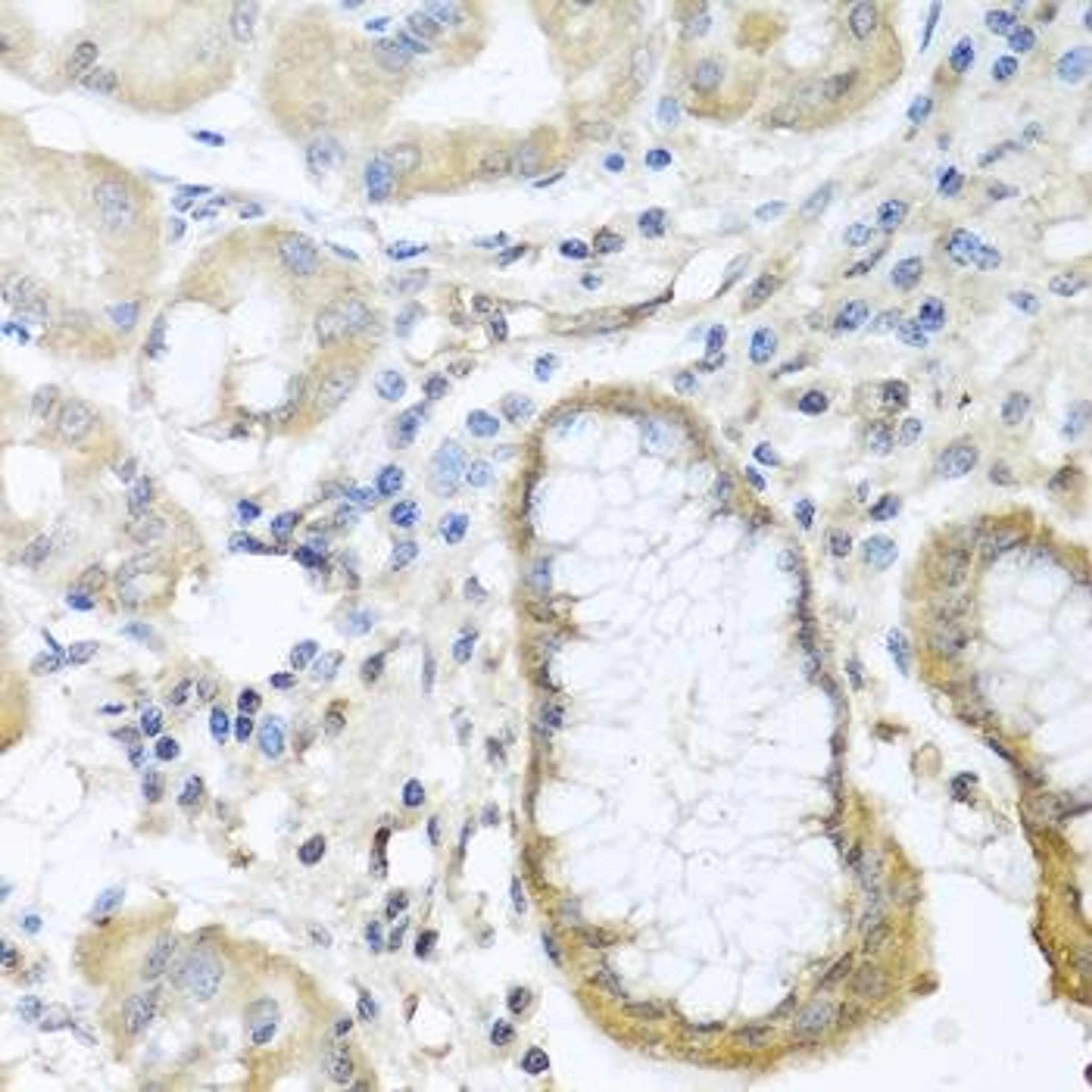 Immunohistochemical staining of rat lung tissue using CCL11 antibody (dilution of 1:100)