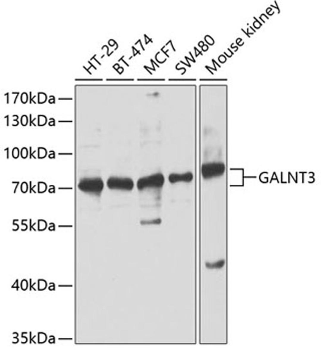 Western blot - GALNT3 antibody (A13985)