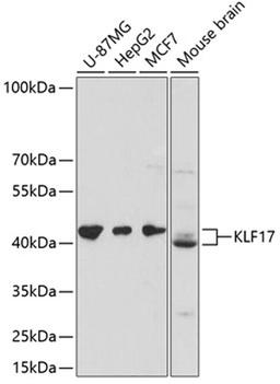 Western blot - KLF17 antibody (A13743)