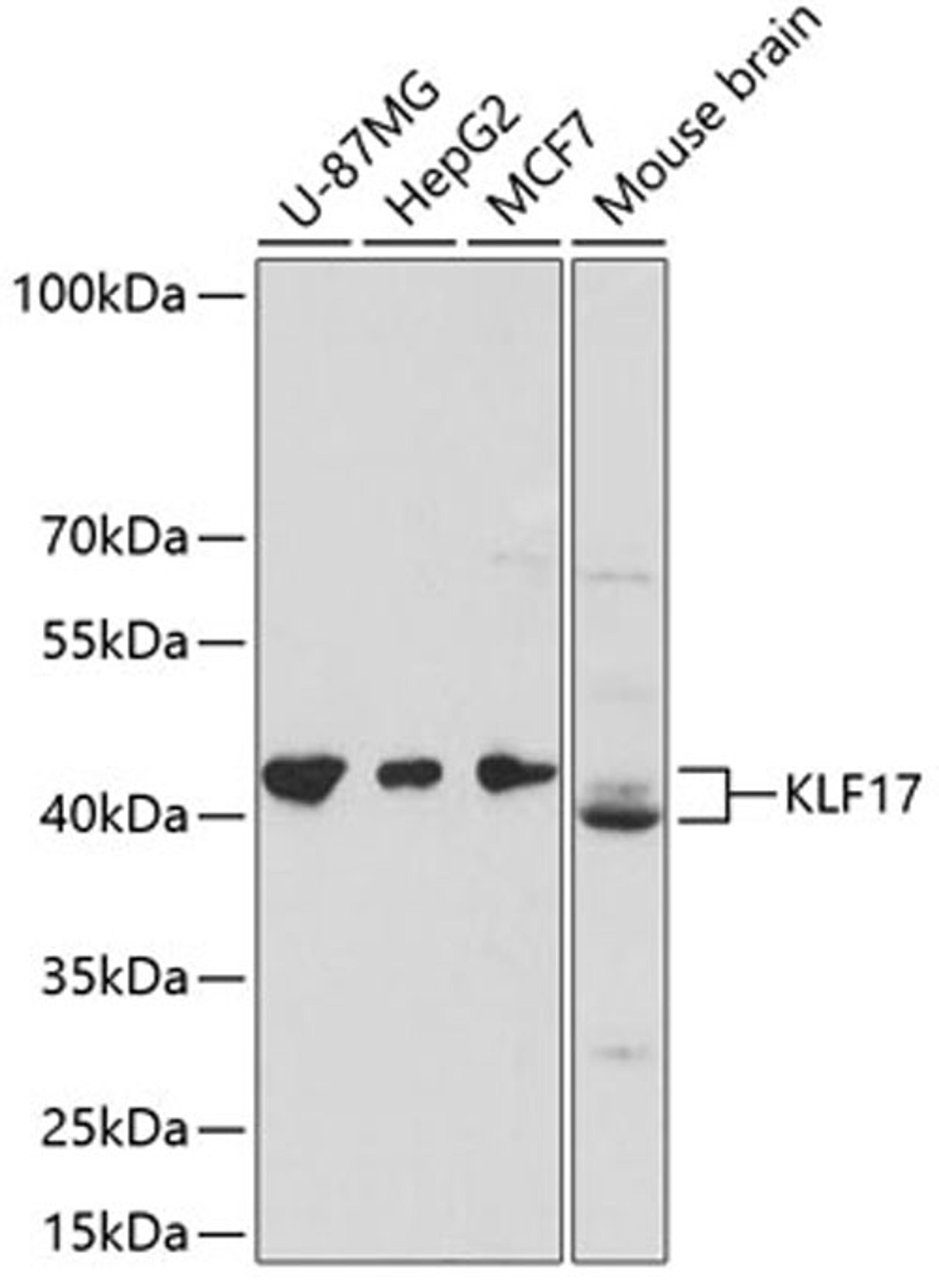 Western blot - KLF17 antibody (A13743)