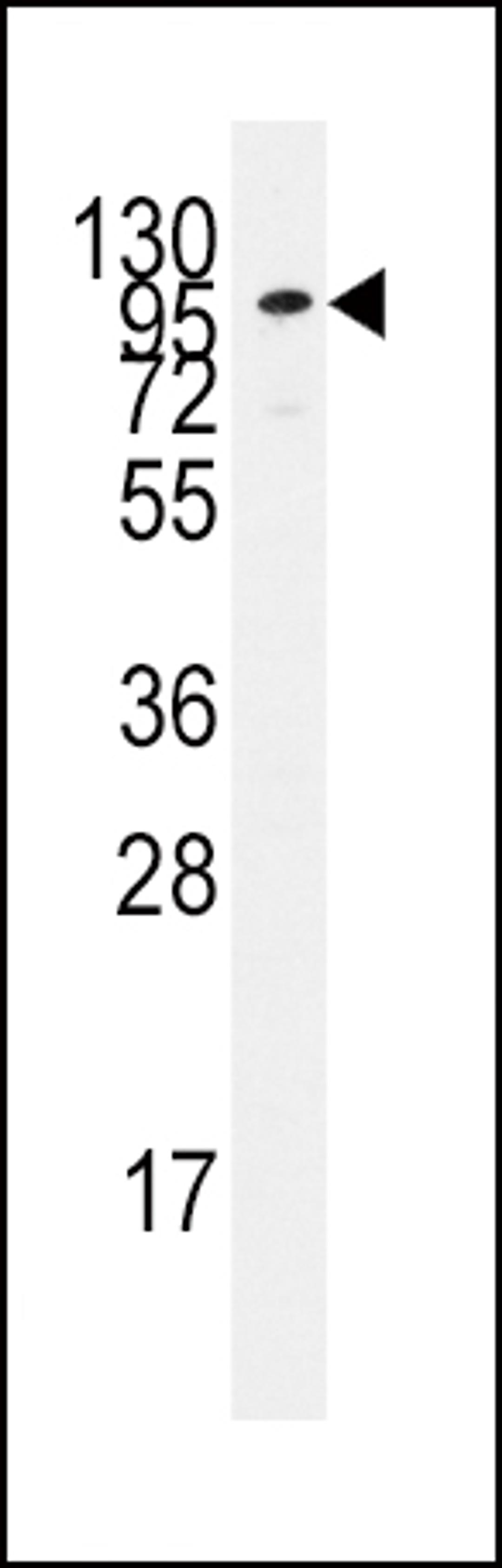 Western blot analysis of anti-ADCY2 Pab in Jurkat cell line lysates (35ug/lane).