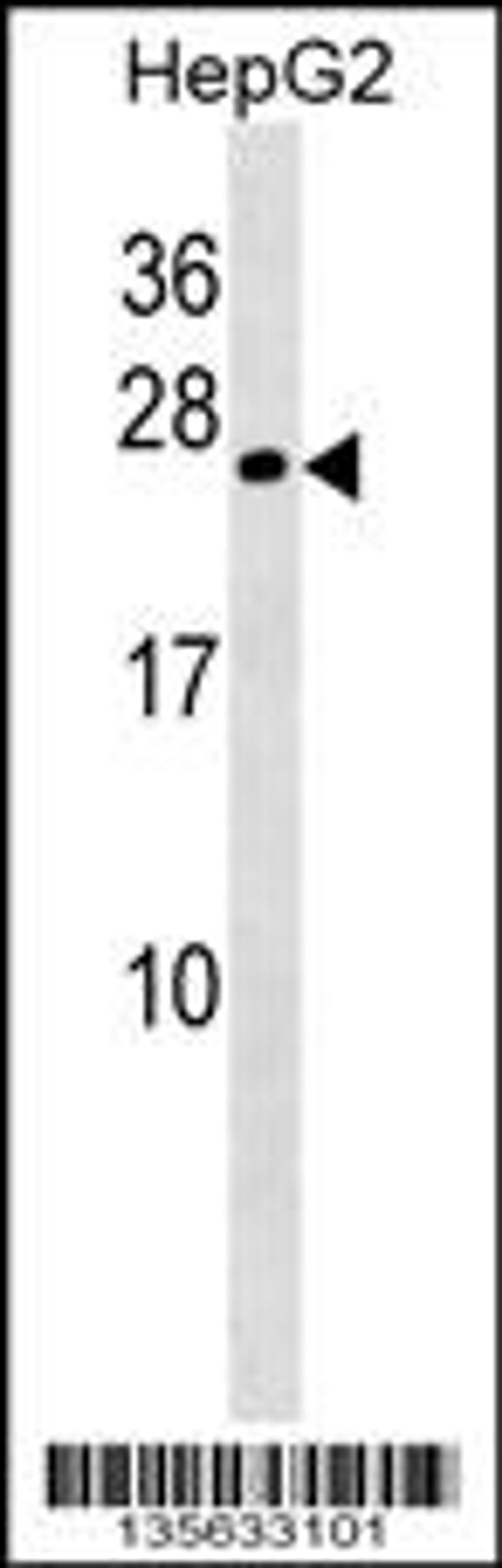 Western blot analysis in HepG2 cell line lysates (35ug/lane).