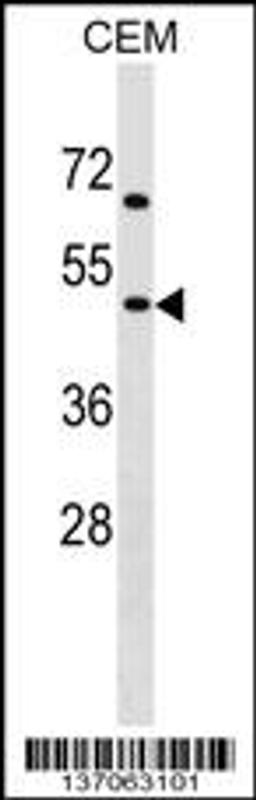 Western blot analysis in CEM cell line lysates (35ug/lane).