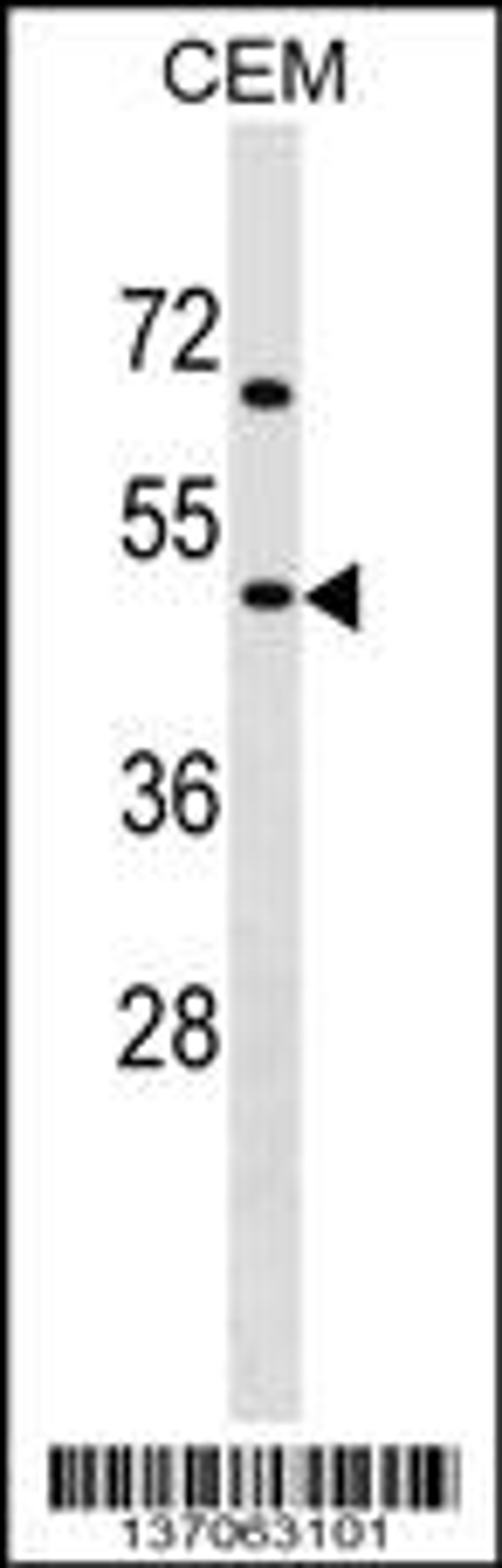 Western blot analysis in CEM cell line lysates (35ug/lane).