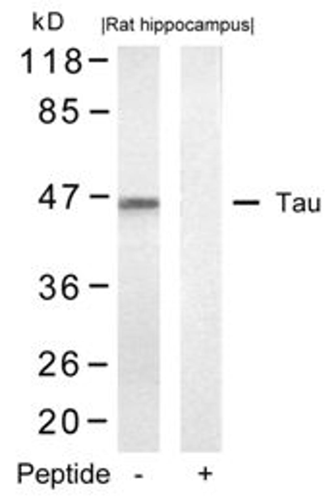 Western blot analysis of lysed extracts from rat hippocampus tissue using Tau (Ab-422).