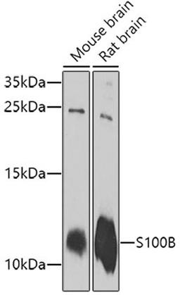 Western blot - S100B antibody (A0676)