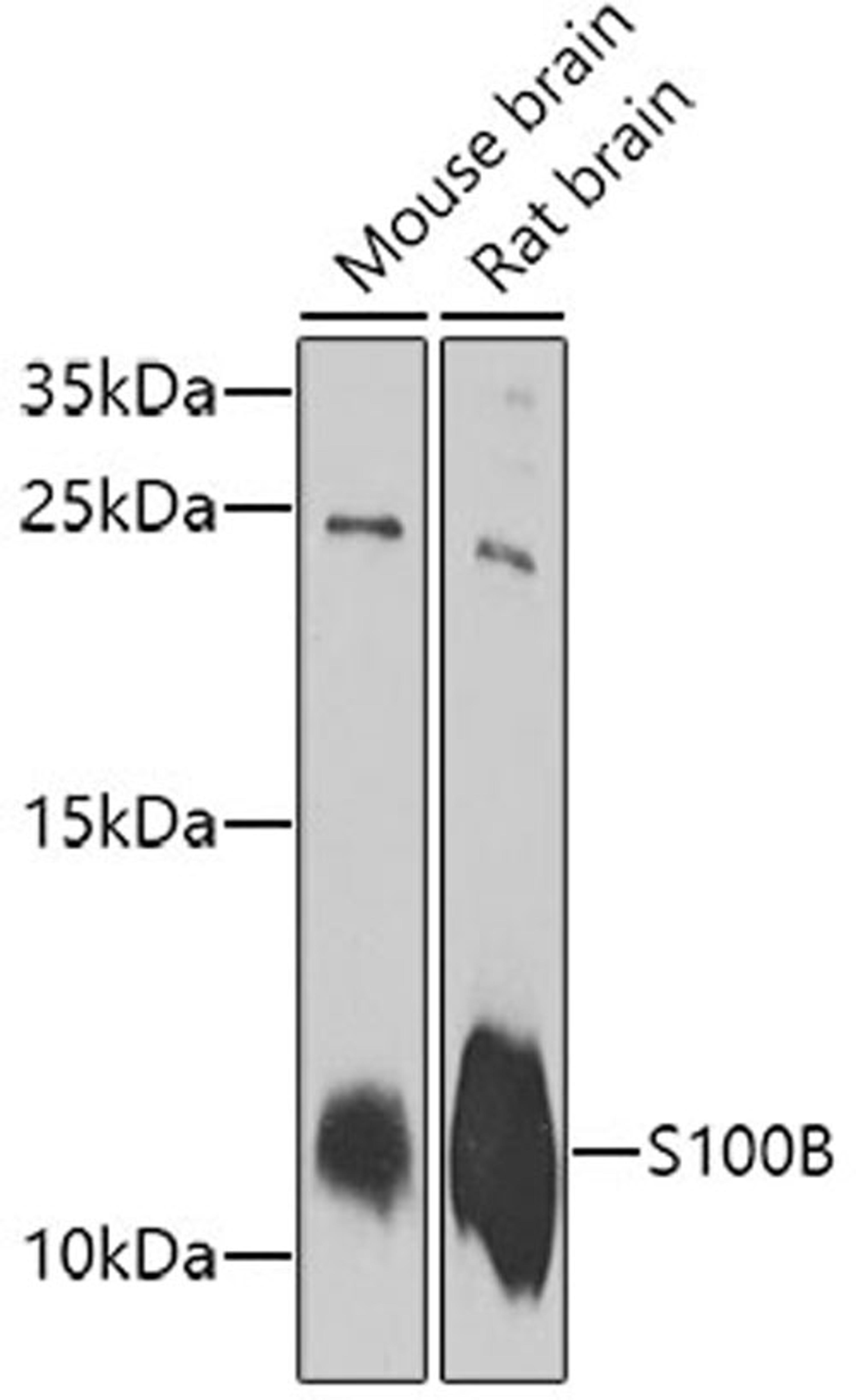 Western blot - S100B antibody (A0676)