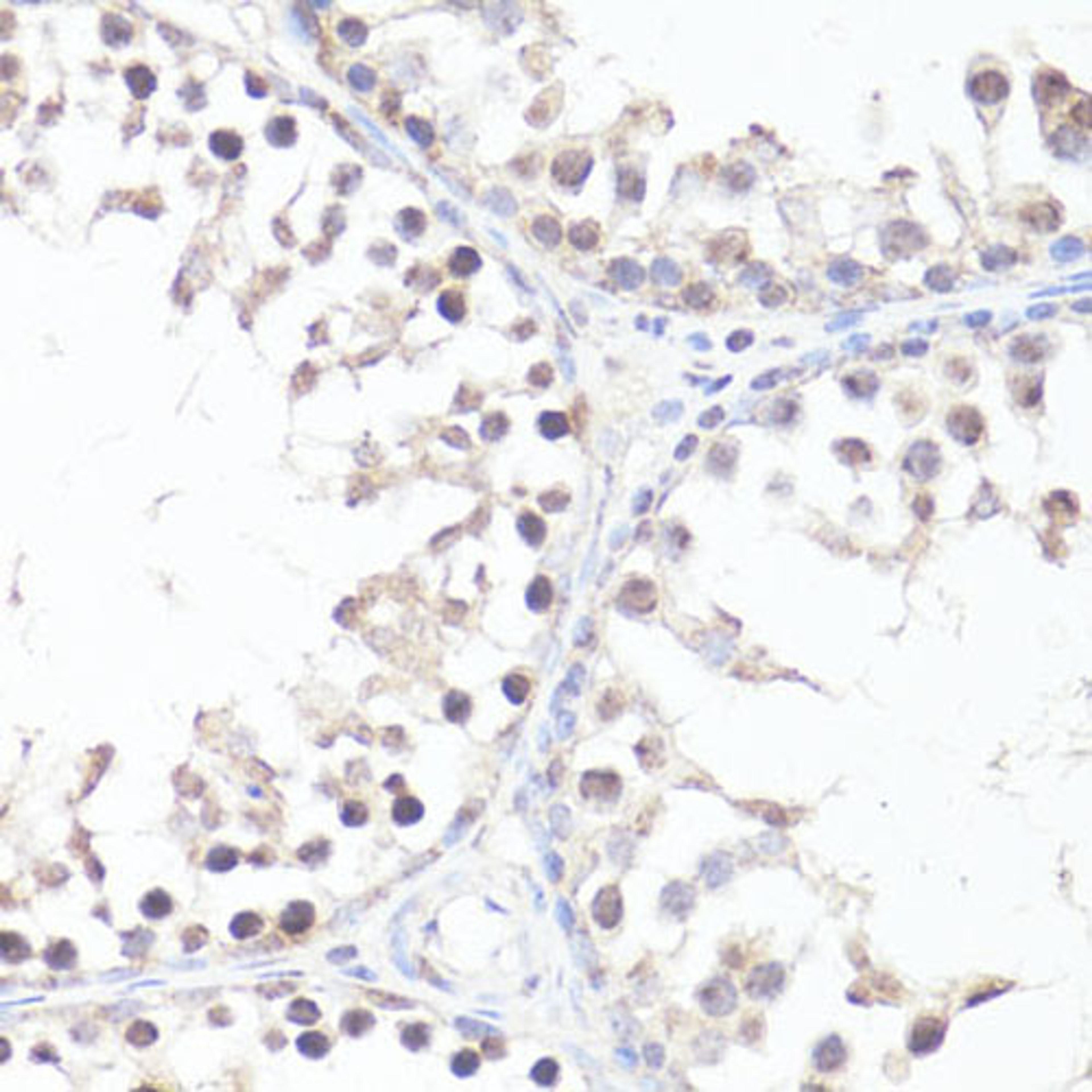 Immunohistochemistry  - P-MYC-T58 antibody (AP0080)