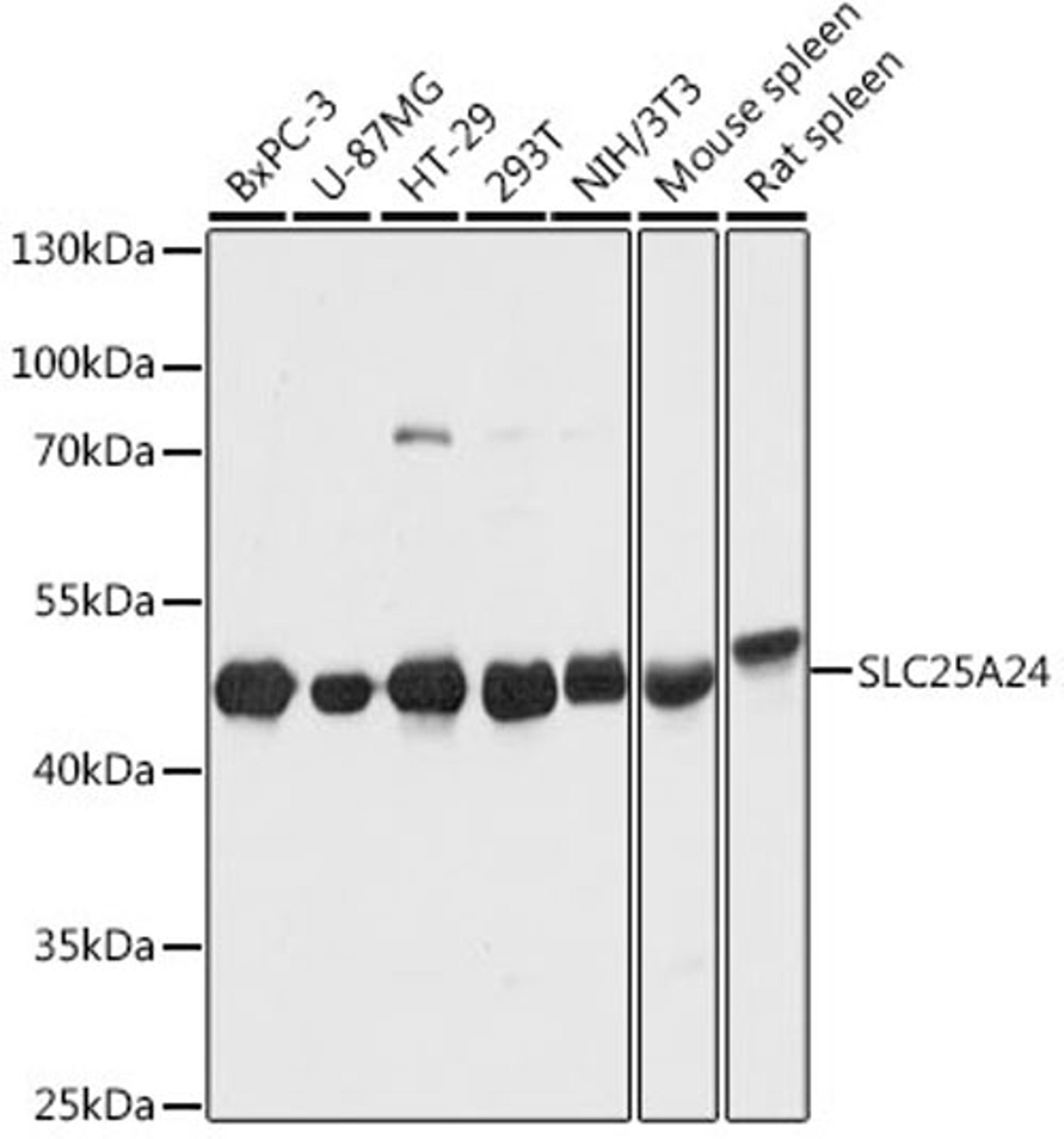 Western blot - SLC25A24 antibody (A12138)