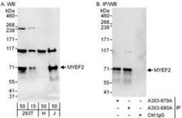 Detection of human MYEF2 by western blot and immunoprecipitation.