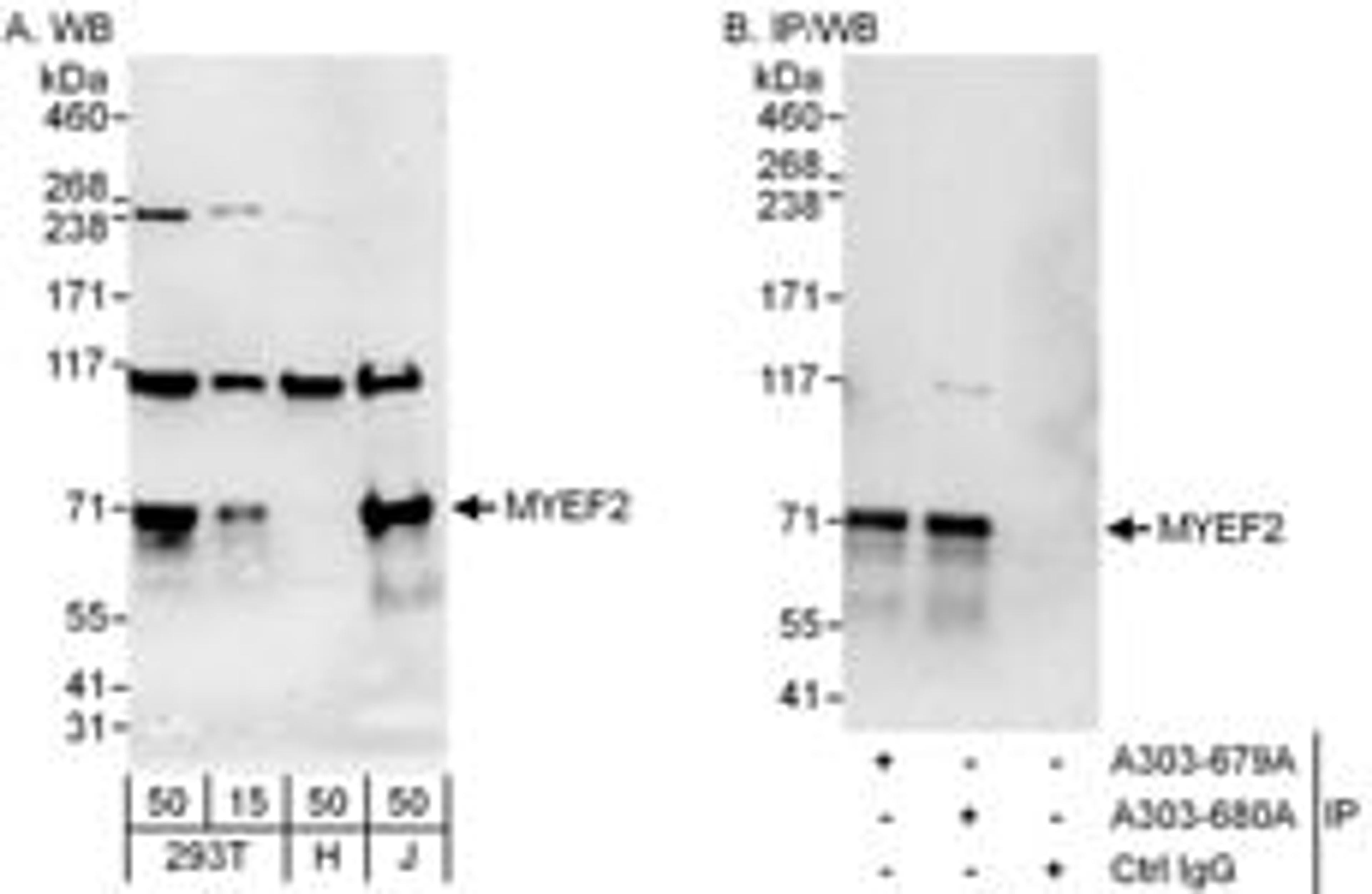 Detection of human MYEF2 by western blot and immunoprecipitation.