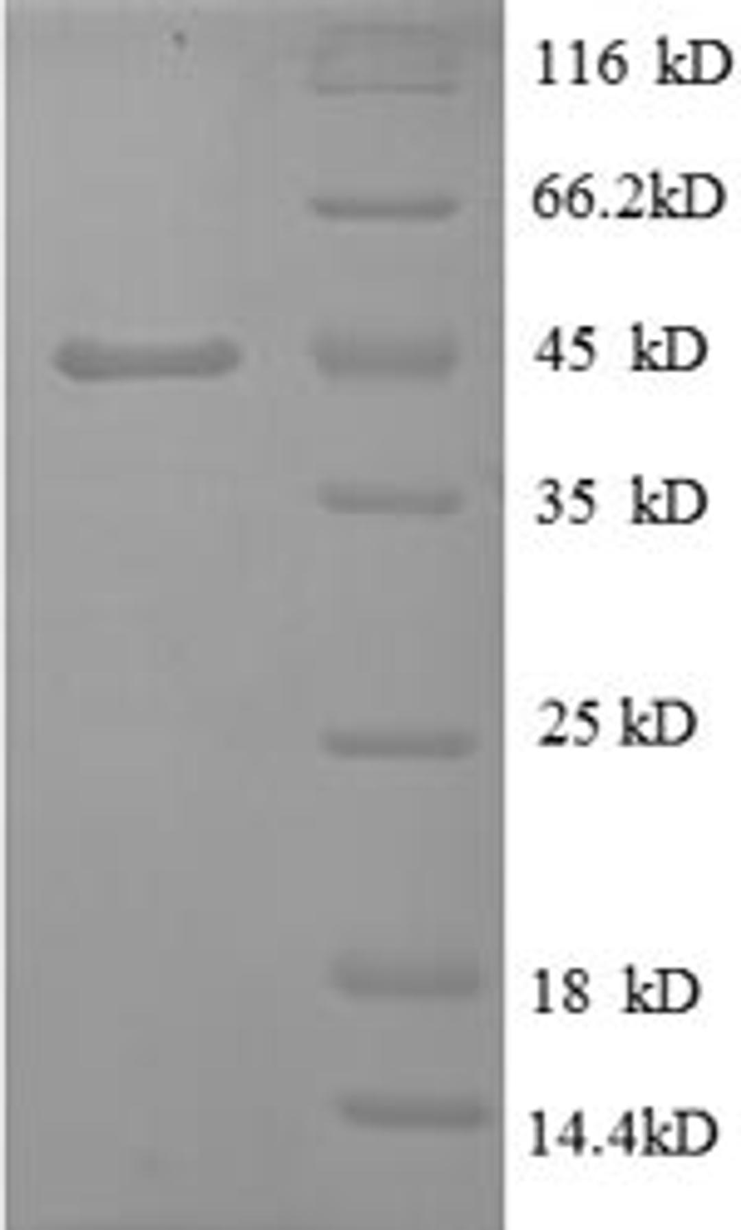 (Tris-Glycine gel) Discontinuous SDS-PAGE (reduced) with 5% enrichment gel and 15% separation gel.