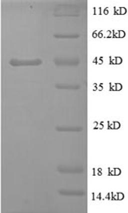 (Tris-Glycine gel) Discontinuous SDS-PAGE (reduced) with 5% enrichment gel and 15% separation gel.