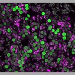 Immunofluorescence: FOXL2 Antibody [NB100-1277] - analysis of FOXL2 in PFA-fixed, E14.5 mouse ovary section using anti-FOXL2 antibody (magenta), germ cell marker (green) and hoechst (grey). Image from verified customer review.