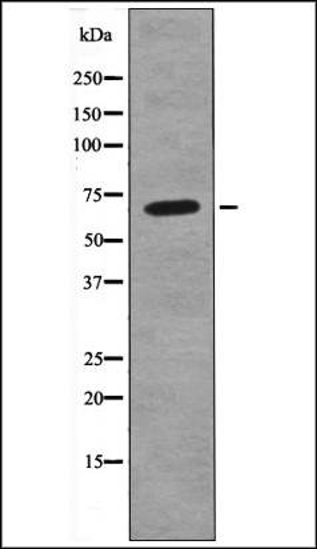 Western blot analysis of P Rat kidneytissue lysates using A-RAF -Phospho-Ser299- antibody