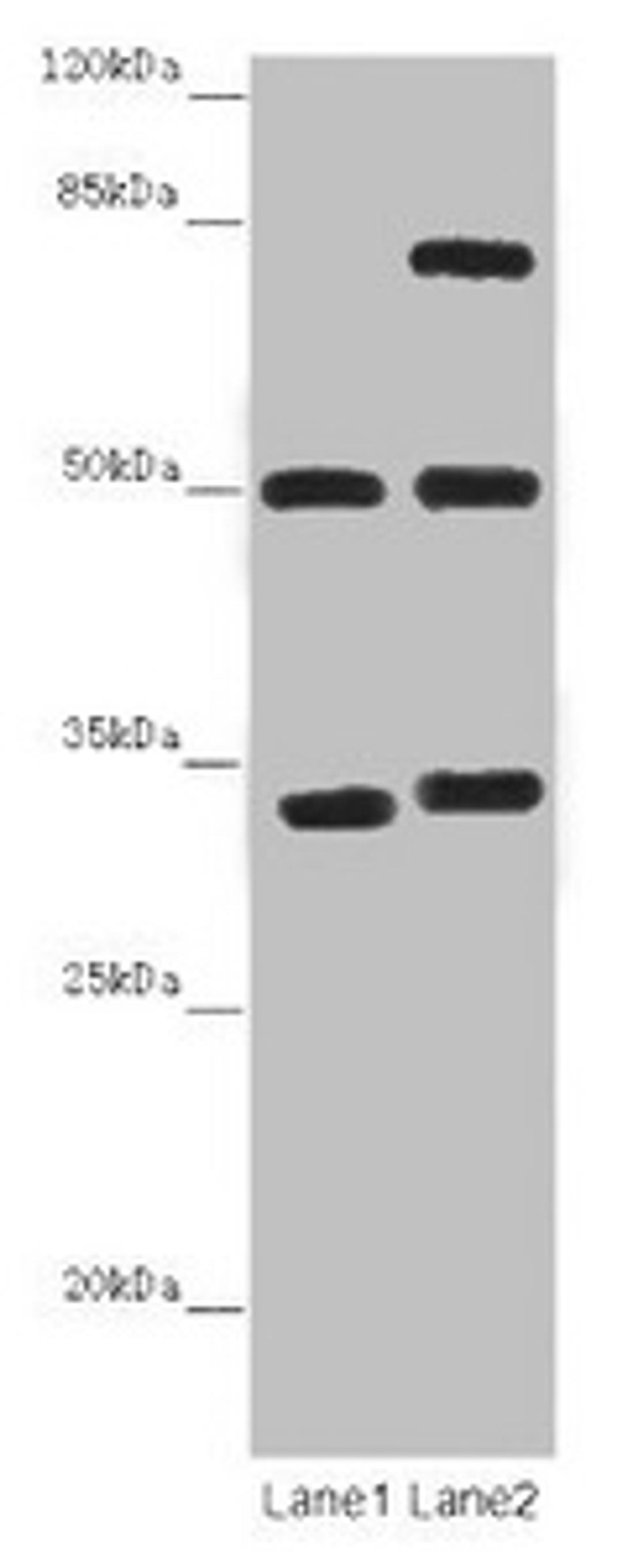 Western blot. All lanes: TUBA1B antibody at 12 µg/ml. Lane 1: Mouse brain tissue. Lane 2: Mouse liver tissue. Secondary. Goat polyclonal to rabbit IgG at 1/10000 dilution. Predicted band size: 51, 38 kDa. Observed band size: 51, 34, 75 kDa