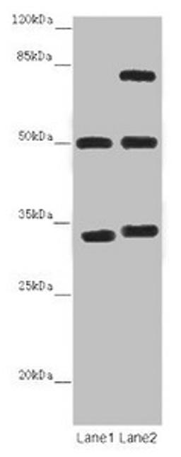 Western blot. All lanes: TUBA1B antibody at 12 µg/ml. Lane 1: Mouse brain tissue. Lane 2: Mouse liver tissue. Secondary. Goat polyclonal to rabbit IgG at 1/10000 dilution. Predicted band size: 51, 38 kDa. Observed band size: 51, 34, 75 kDa