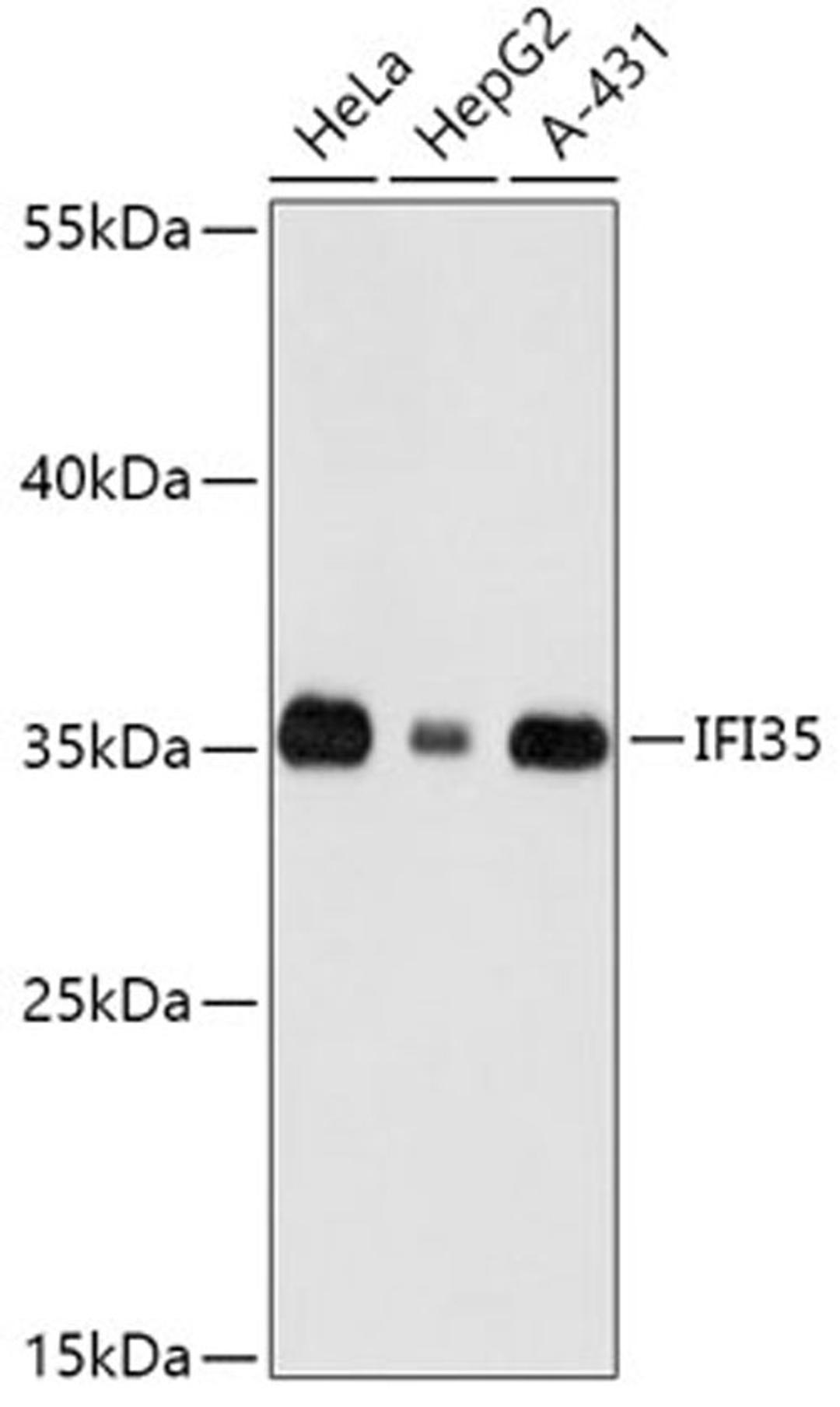 Western blot - IFI35 antibody (A16384)