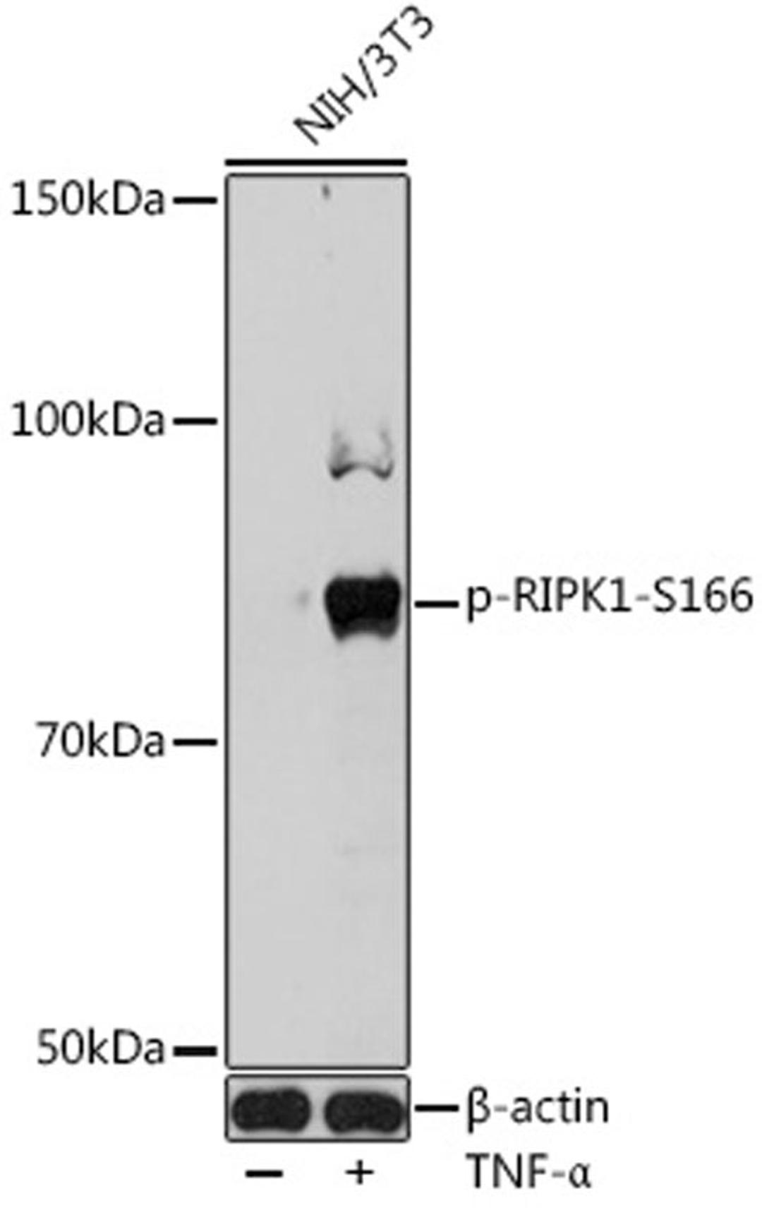 Western blot - Phospho-RIPK1-S166 antibody (AP1115)