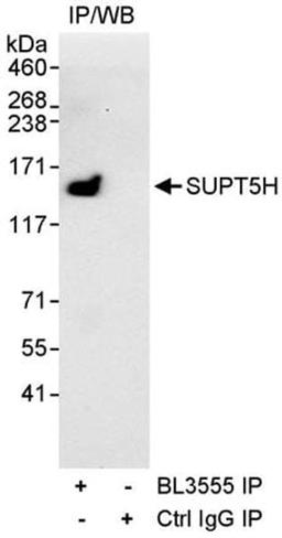 Detection of human SUPT5H by western blot of immunoprecipitates.