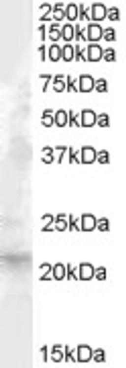 46-658 (1ug/ml) staining of Human Liver lysate (35ug protein in RIPA buffer). Primary incubation was 1 hour. Detected by chemiluminescence.