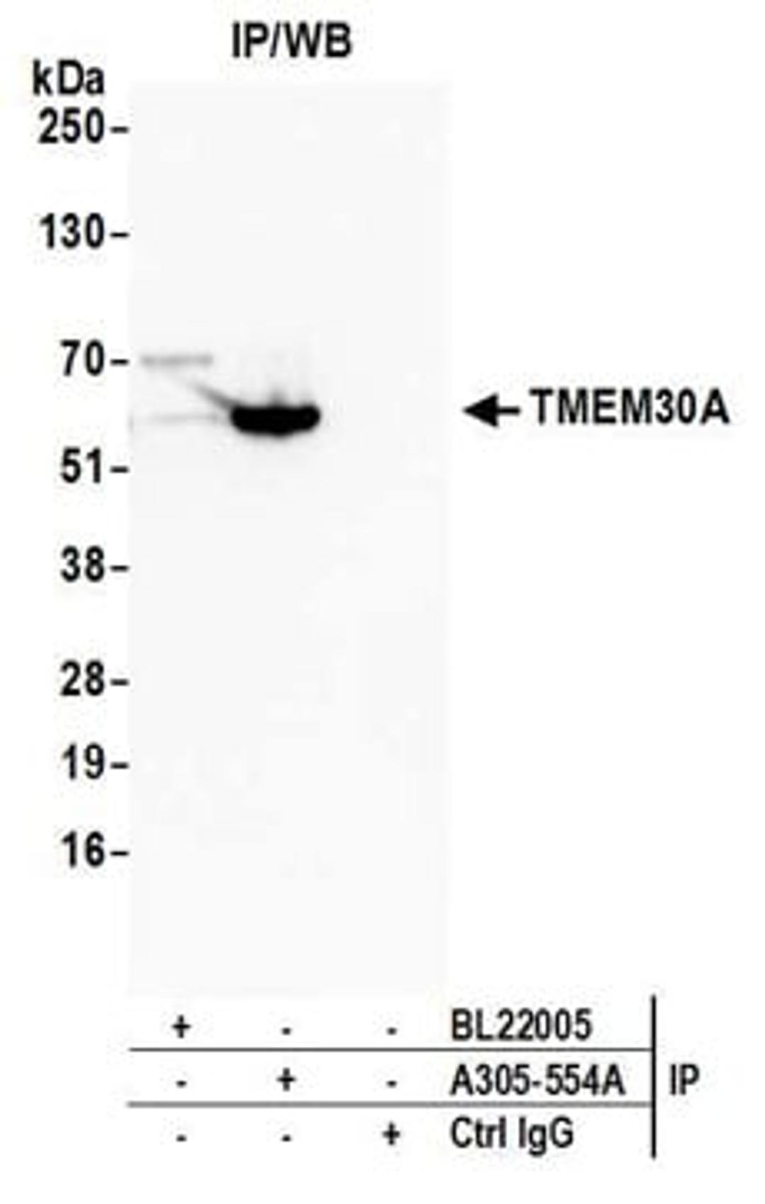 Detection of human TMEM30A by western blot of immunoprecipitates.