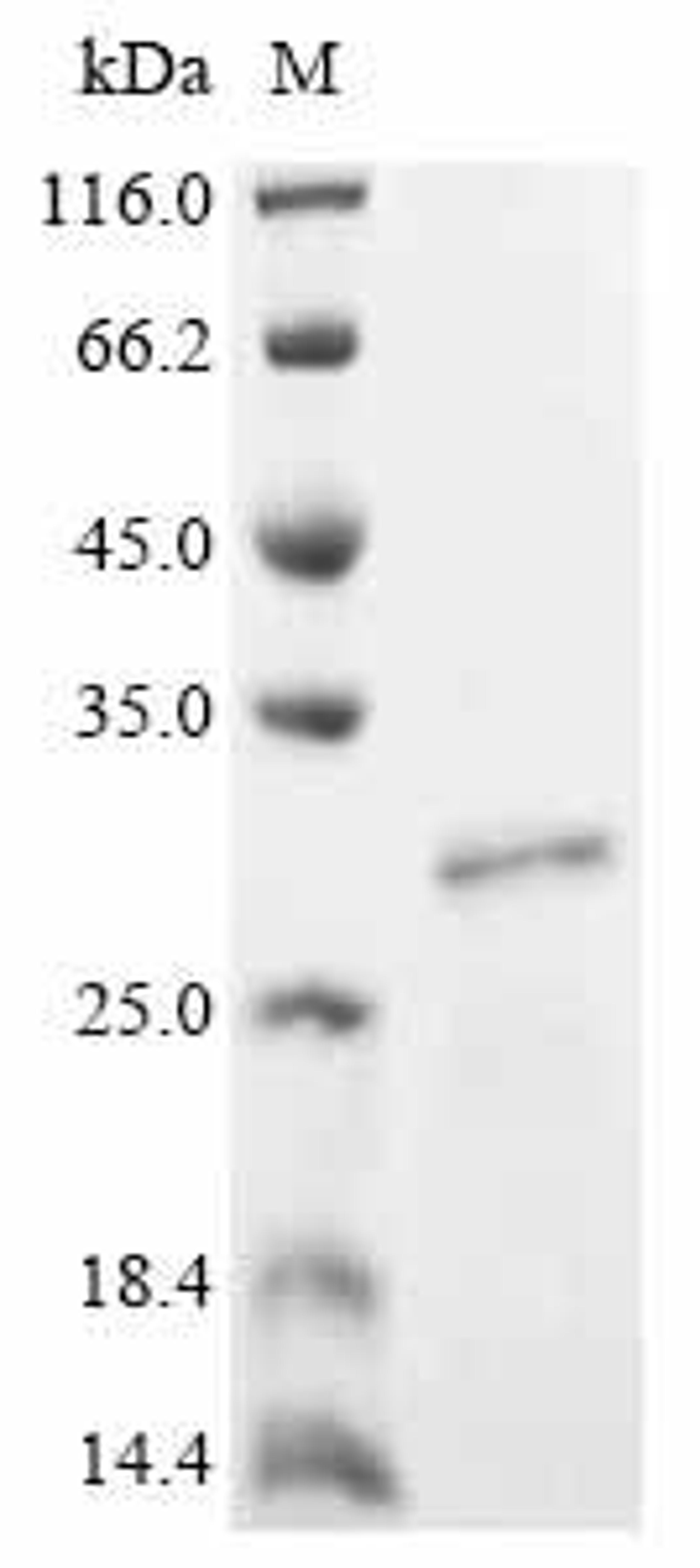 (Tris-Glycine gel) Discontinuous SDS-PAGE (reduced) with 5% enrichment gel and 15% separation gel.